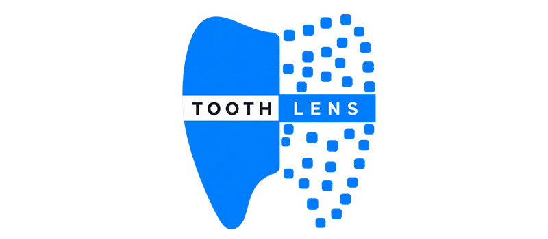 Tooth-lens